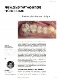 2017-aménagement-orthodontique-préprothétiquedib-375x500