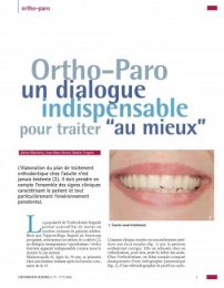 orthodontie-linguale_Page_1-353×500 orthodontie-linguale_Page_1-353x500