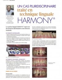 technique_linguale_Harmony-354×500 technique_linguale_Harmony-354x500